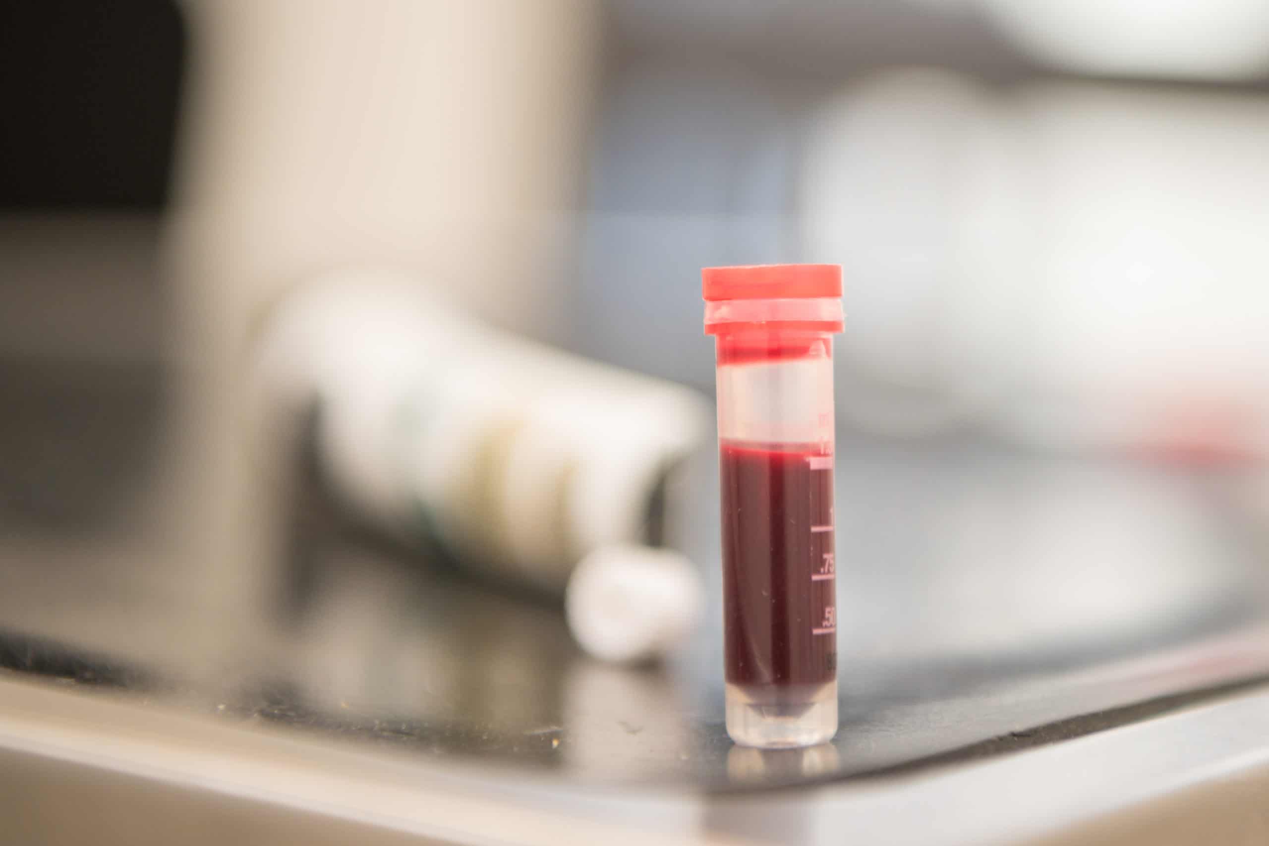 Red Blood samples for analysis in a test tube