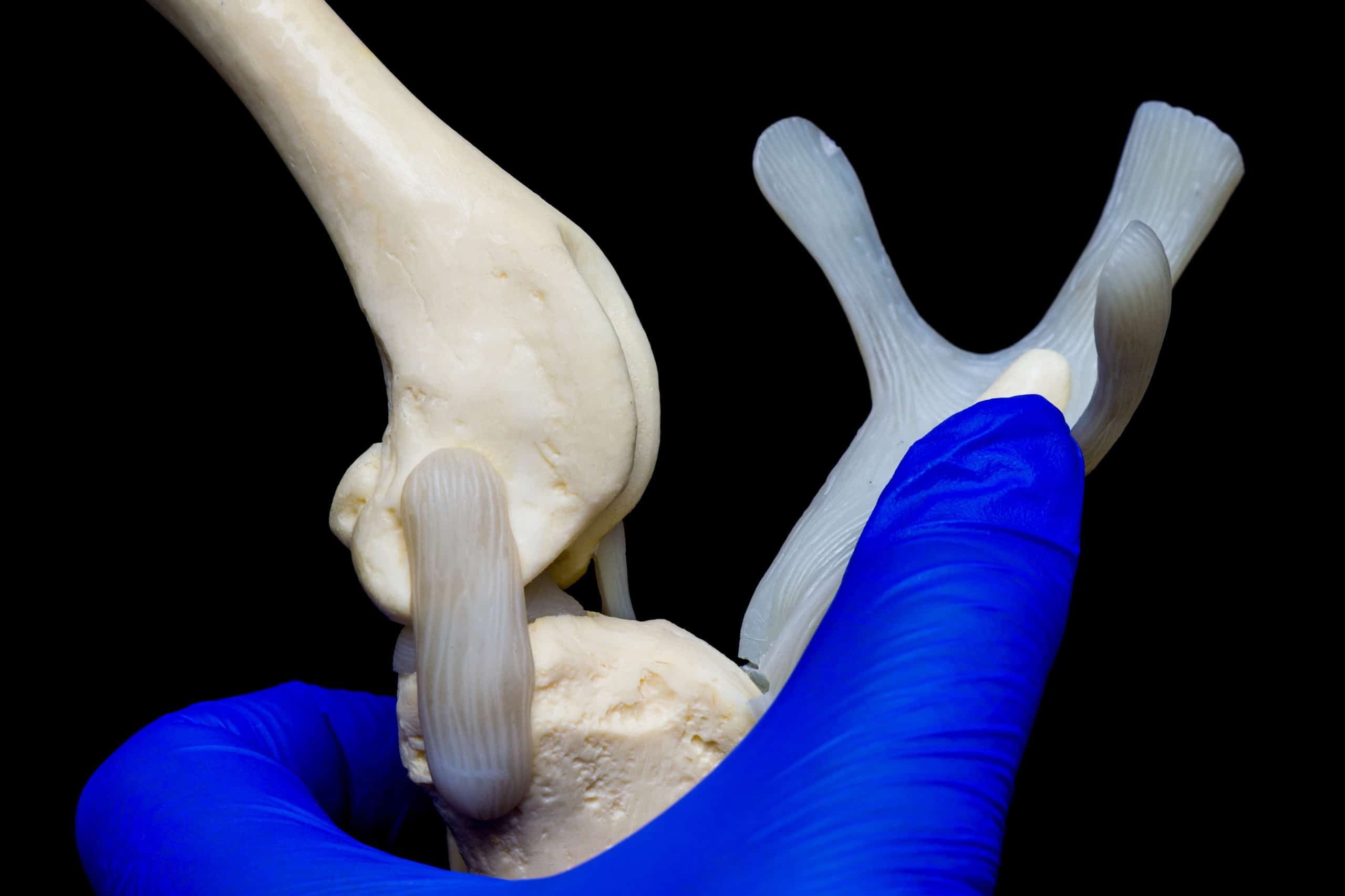 dog knee joint mold in the hand of the veterinarian and black background